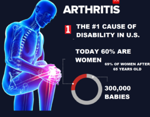 Arthritis – Joint Issues – Fitness – Nutrition, Weight Loss, Cellulite Treatment and Menopause ahhhh!